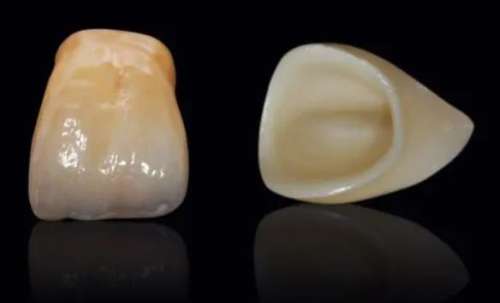 上海凸嘴整形手術(shù)：醫(yī)生技術(shù)、價(jià)格分析及手術(shù)前必備資料