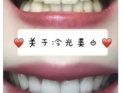 http://m.bstoo.cn/d/file/rank/3pi3k6gehs0z.jpg