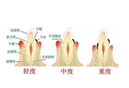 南京口腔診所排行榜前三，專家推薦！