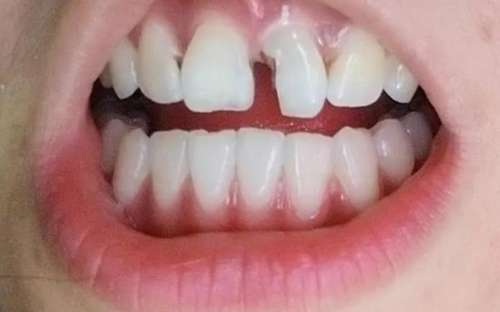 南京口腔醫(yī)院掛號預(yù)約攻略【口腔醫(yī)生、地址、收費價格表】