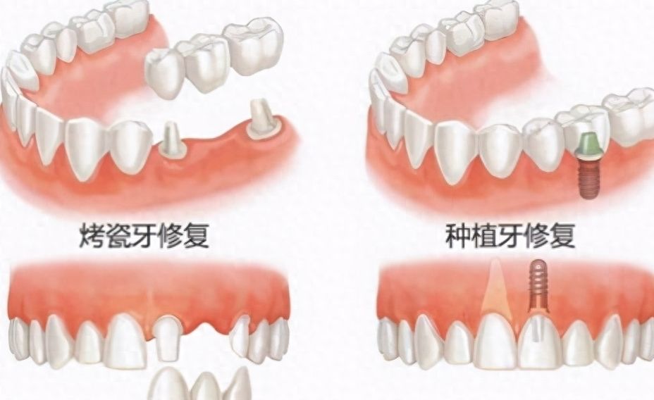 上海青苗兒童口腔口碑？崔聰聰和魯莉萍醫(yī)生介紹