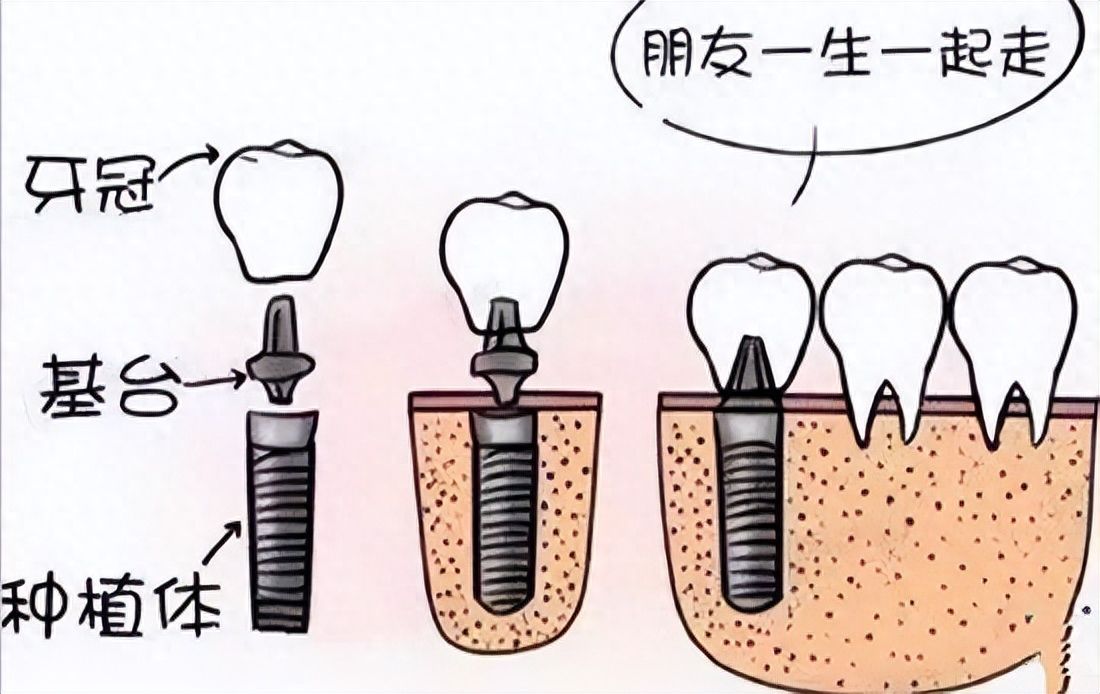 http://m.bstoo.cn/d/file/rank/5cmljbr03x.jpg