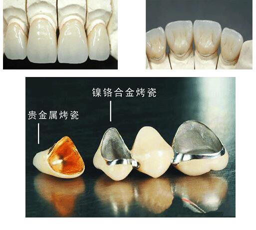 http://m.bstoo.cn/d/file/rank/92fx6mkh0aeu.jpg