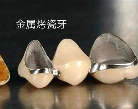 杭州口腔醫(yī)療機(jī)構(gòu)醫(yī)院對比：實力與醫(yī)生詳解