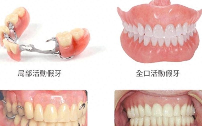上海九院牙齒矯正達(dá)人親薦！這幾位醫(yī)生口碑強(qiáng)