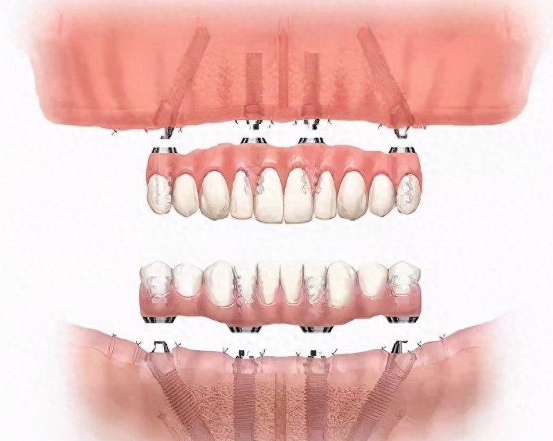http://m.bstoo.cn/d/file/rank/bgjarq9i3bxr.jpg