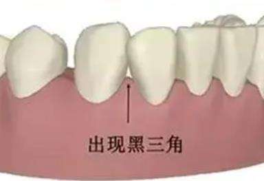 廣州華晨口腔醫(yī)院種植矯正醫(yī)生背景案例真實(shí)反饋
