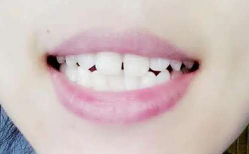 http://m.bstoo.cn/d/file/rank/calpx7hdseyg.jpg