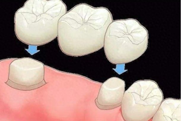 http://m.bstoo.cn/d/file/rank/cbmdl009x3or.jpg