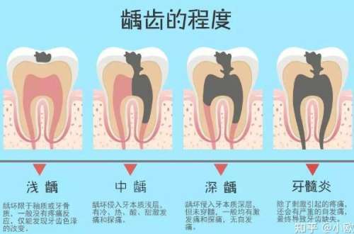 蛇口人民醫(yī)院種牙科：項(xiàng)目解析及醫(yī)生推薦