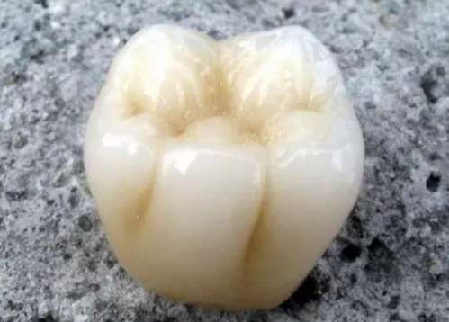 浙大一院余杭口腔科醫(yī)生團(tuán)隊(duì)實(shí)力揭秘：專業(yè)治療與便捷就診攻略