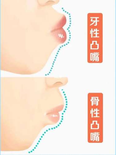 http://m.bstoo.cn/d/file/rank/fin0vlegmg0a.jpg