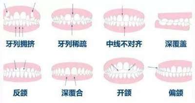 http://m.bstoo.cn/d/file/rank/gtkuohofh2wy.jpg