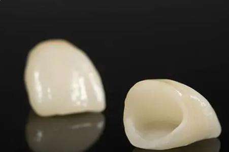 成都哪家牙科矯正技術(shù)強？瑞安口腔專家實力、案例了解