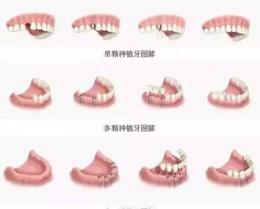 上海尤旦口腔口碑好不好？醫(yī)院地址、醫(yī)生和收費(fèi)參考