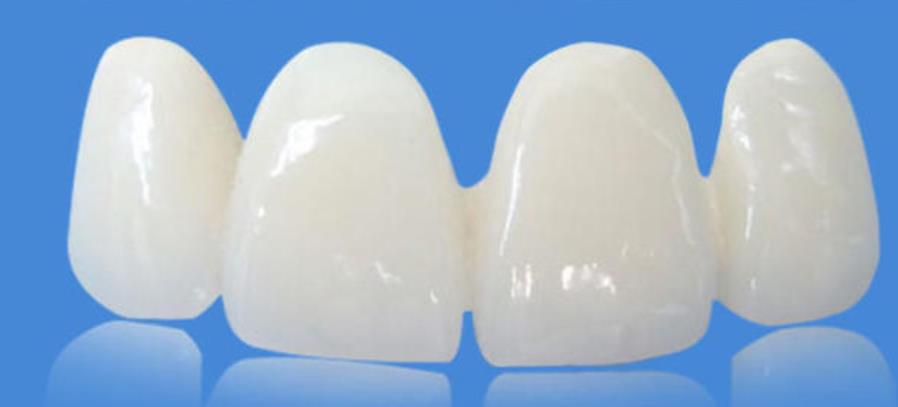 http://m.bstoo.cn/d/file/rank/ld78r75nxp.jpg