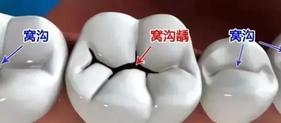 http://m.bstoo.cn/d/file/rank/llo53m2jagut.jpg