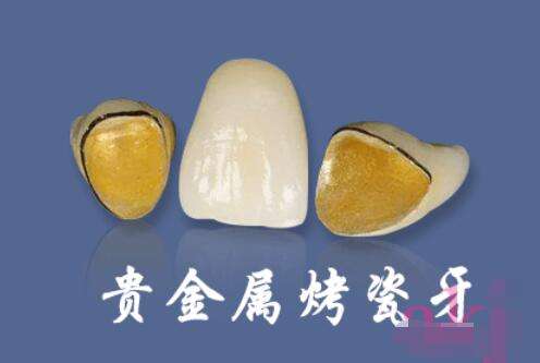 http://m.bstoo.cn/d/file/rank/mixsm96w1lmu.jpg