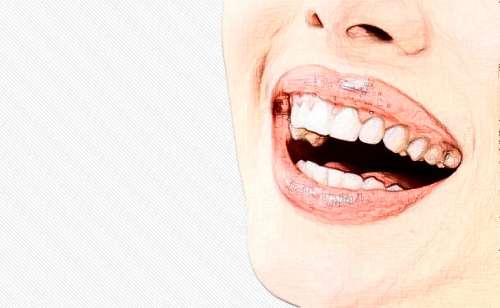 福州維樂口腔網(wǎng)上預(yù)約掛號：陳獻(xiàn)禮、郭淑蘋醫(yī)生預(yù)約方式解析