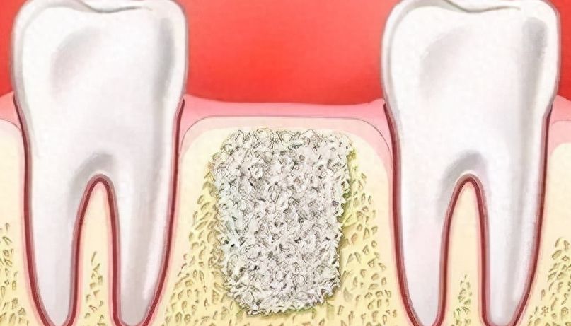 北京正畸專家評(píng)價(jià)徐寶華、張棟梁治療水平