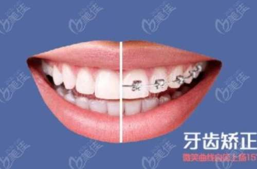 http://m.bstoo.cn/d/file/rank/nb87jb4if5.jpg