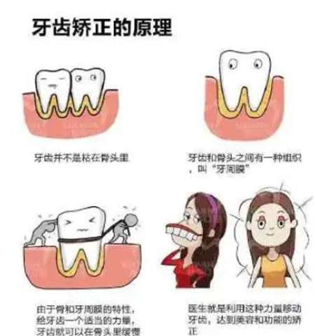 深圳寶安區(qū)牙科醫(yī)院推薦：附醫(yī)生介紹、矯正價格及真實案例分享