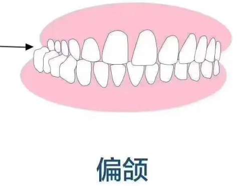 白云區(qū)牙齒矯正口碑好的口腔醫(yī)生大公開：這份榜單千萬別錯過