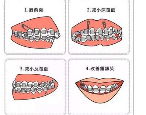 http://m.bstoo.cn/d/file/rank/rog08pc317em.jpg