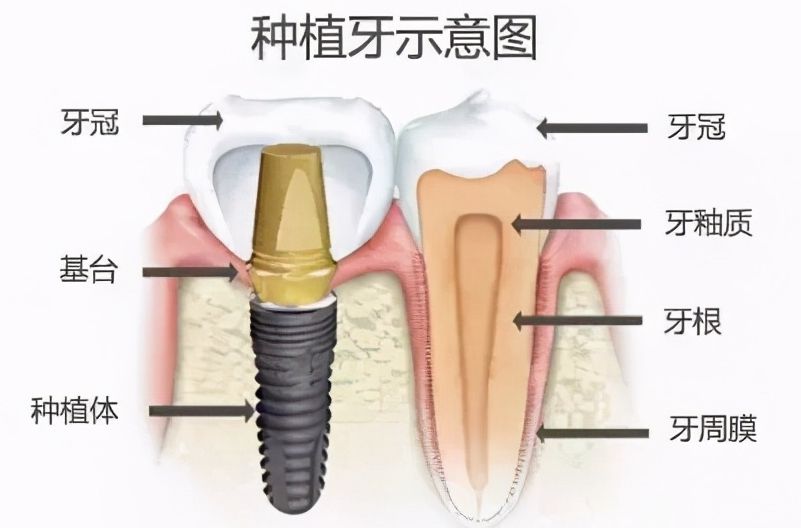 德州美和口腔門診部靠譜嗎？深度解析：醫(yī)生團(tuán)隊、特色服務(wù)及收費(fèi)標(biāo)準(zhǔn)