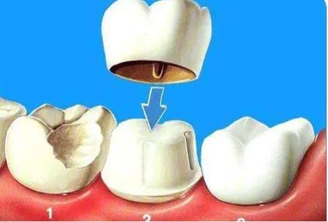 http://m.bstoo.cn/d/file/rank/t8wtnbbxtwrc.jpg