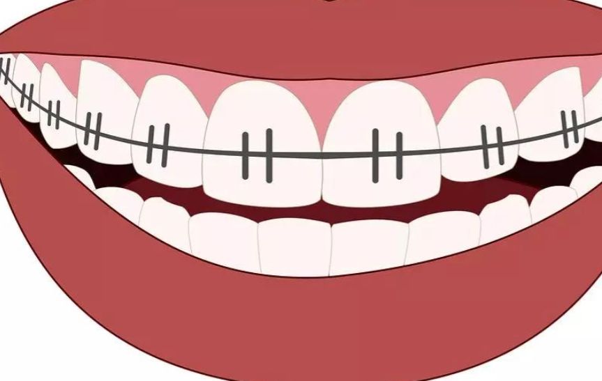 合肥長(zhǎng)庚口腔科好不好？揭秘醫(yī)生團(tuán)隊(duì)與精彩案例