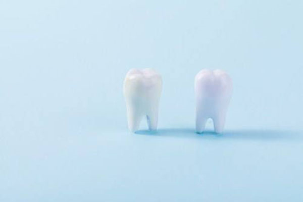 華西口腔醫(yī)院專家牙醫(yī)技術詳解：賴文莉、劉鈞、滿毅