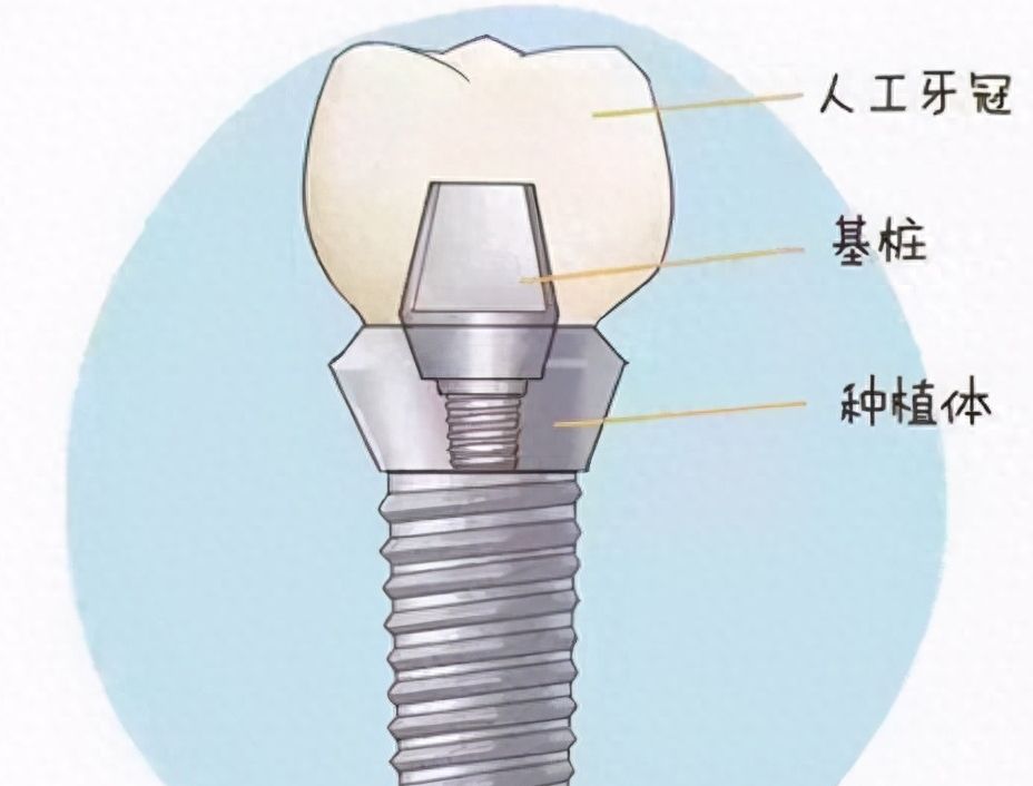 http://m.bstoo.cn/d/file/rank/vsf40w703j1t.jpg