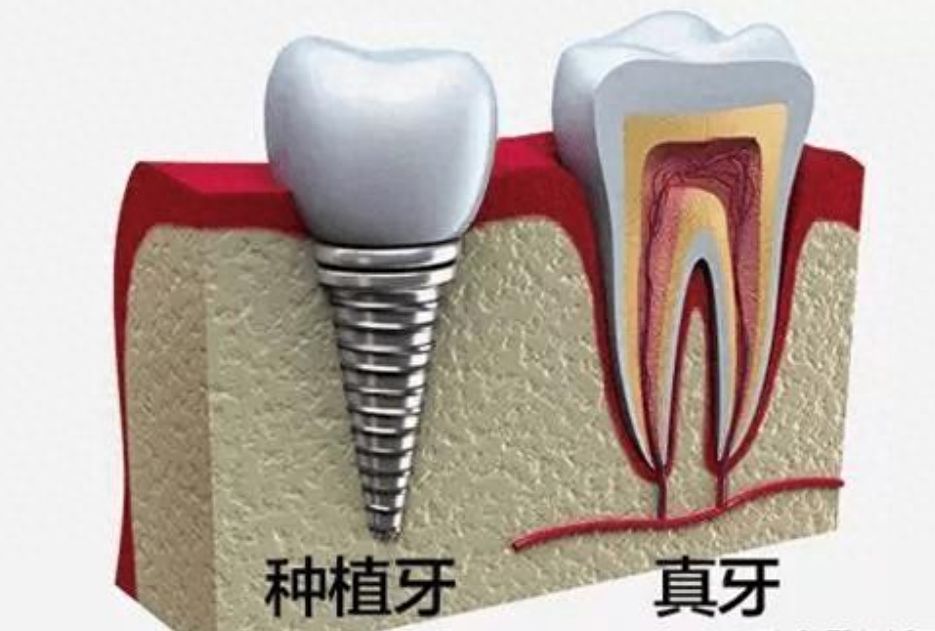 http://m.bstoo.cn/d/file/rank/w9jz0izhz961.jpg