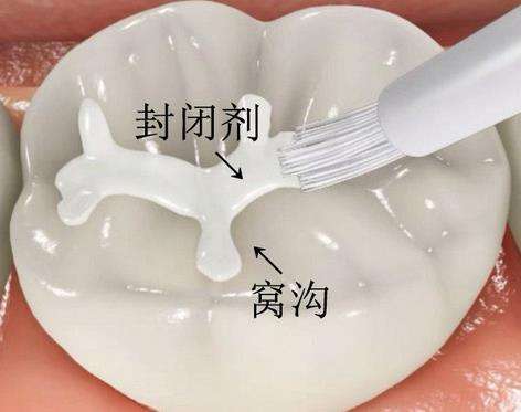 http://m.bstoo.cn/d/file/rank/w9ufmyljc8fb.jpg