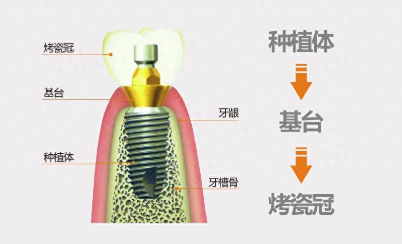 http://m.bstoo.cn/d/file/rank/wpsql562zwa5.jpg