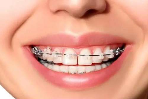 http://m.bstoo.cn/d/file/rank/xn300qd5iyd8.jpg