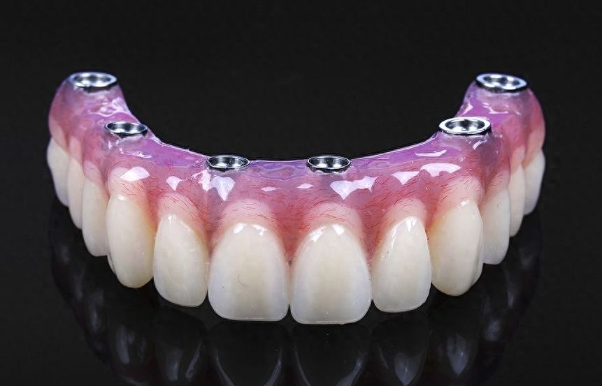 廈門口腔醫(yī)院正畸科醫(yī)生排名及手術(shù)費(fèi)用一覽