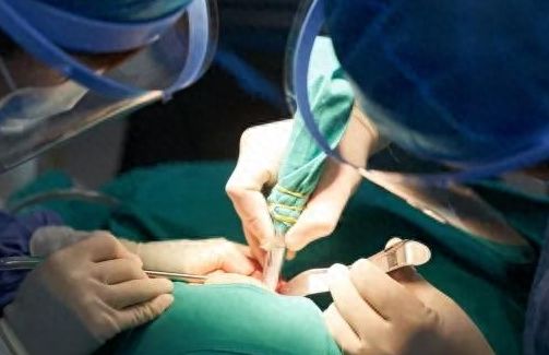 南京美奧口腔牙齒矯正攻略：朱峰、陳玉潔醫(yī)生技術(shù)解析
