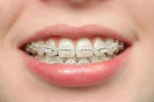 昆明醫(yī)科大學(xué)附屬口腔醫(yī)院坐診醫(yī)生及價目表詳解